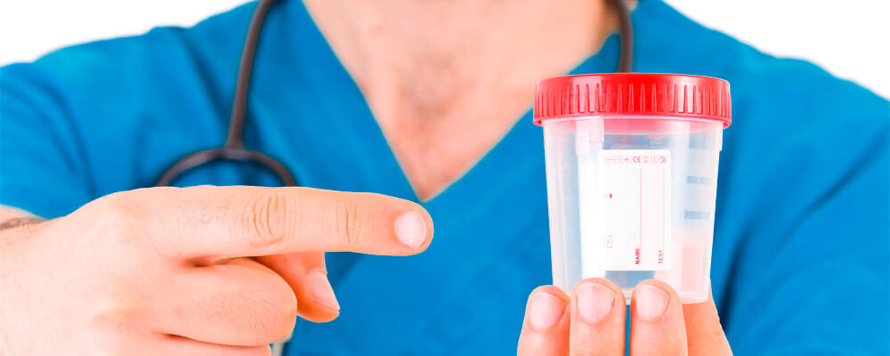 CBD e test antidroga